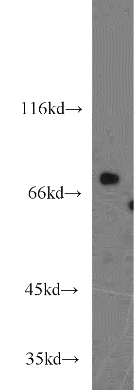 PC-3 cells were subjected to SDS PAGE followed by western blot with Catalog No:116146(TNK1 antibody) at dilution of 1:1200