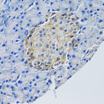 Immunohistochemistry - SLC1A2 Polyclonal Antibody 