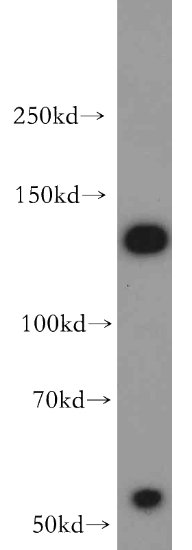 HepG2 cells were subjected to SDS PAGE followed by western blot with Catalog No:107980(ALG13 antibody) at dilution of 1:500