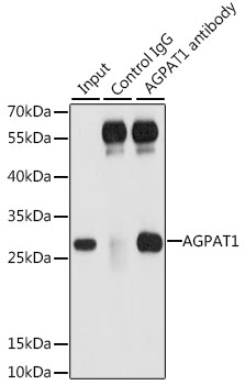 Immunoprecipitation - AGPAT1 Polyclonal Antibody 