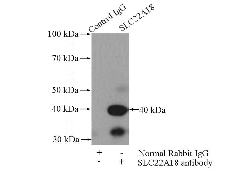 IP Result of anti-SLC22A18 (IP:Catalog No:115314, 4ug; Detection:Catalog No:115314 1:600) with mouse brain tissue lysate 4000ug.
