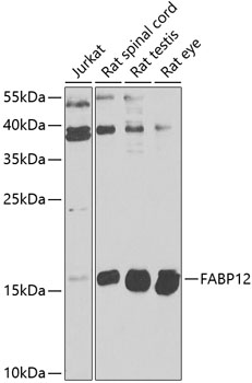 Western blot - FABP12 Polyclonal Antibody 