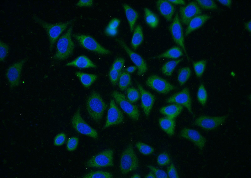 Immunofluorescent analysis of (-20oc Ethanol) fixed HeLa cells using Catalog No:113535(CDKN2B Antibody) at dilution of 1:25 and Alexa Fluor 488-congugated AffiniPure Goat Anti-Rabbit IgG(H+L)