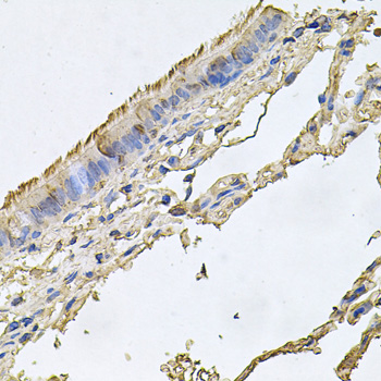 Immunohistochemistry - FABP12 Polyclonal Antibody 