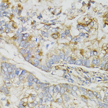 Immunohistochemistry - NDUFS7 Polyclonal Antibody 