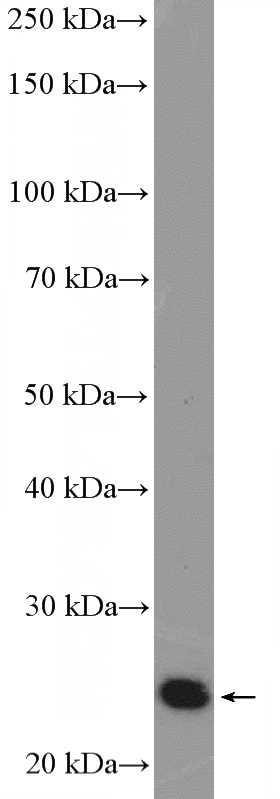 HEK-293 cells were subjected to SDS PAGE followed by western blot with Catalog No:114384(PSMB4 Antibody) at dilution of 1:600