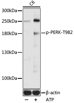 Western blot - Phospho-PERK-T982 pAb 