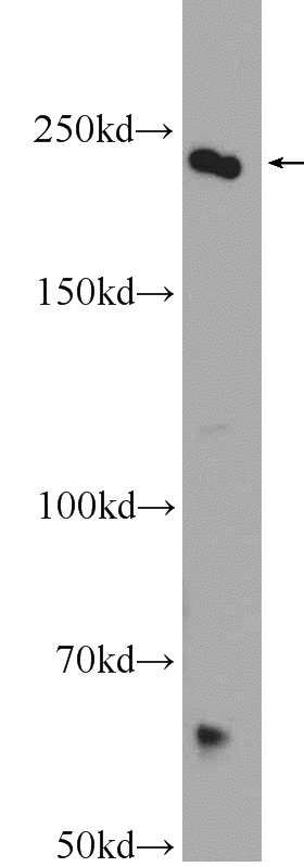 HEK-293 cells were subjected to SDS PAGE followed by western blot with Catalog No:108771(CAD Antibody) at dilution of 1:600