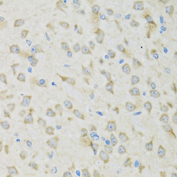 Immunohistochemistry - CLCN7 Polyclonal Antibody 