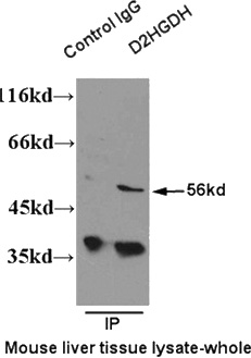 IP result of anti-D2HGDH (Catalog No:109817 for IP and Detection) with mouse liver tissue lysate.