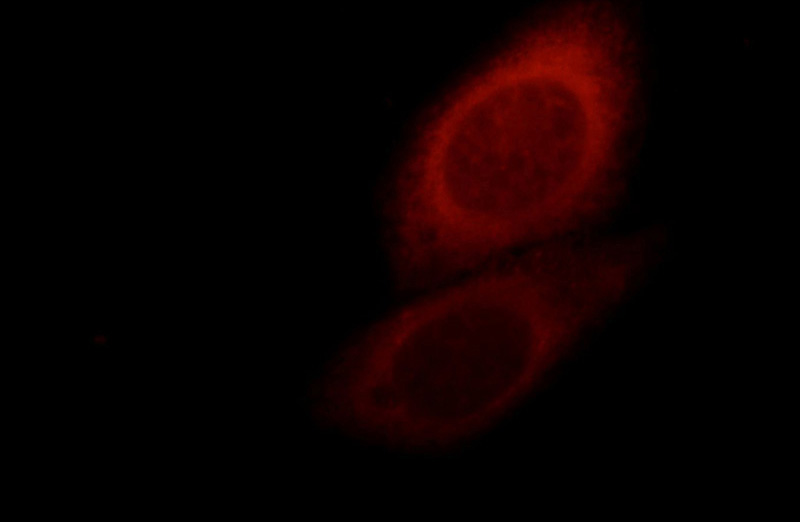 Immunofluorescent analysis of HepG2 cells, using TBL2 antibody Catalog No:109111 at 1:25 dilution and Rhodamine-labeled goat anti-rabbit IgG (red).
