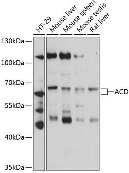 Western blot - ACD Polyclonal Antibody 