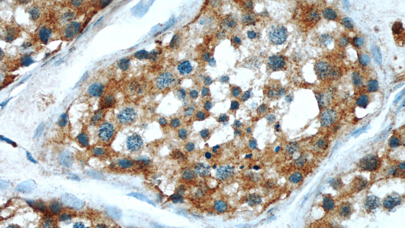 Immunohistochemical of paraffin-embedded human testis using Catalog No:112799(MRAP antibody) at dilution of 1:50 (under 40x lens)