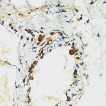 Immunohistochemistry - APOBEC3F Polyclonal Antibody 