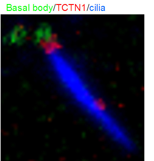 IF result from Dr. Corbit, Kevin. anti-TCTN1(Catalog No:115919) mark the transition zone of Human hTERT-RPE1 cells.