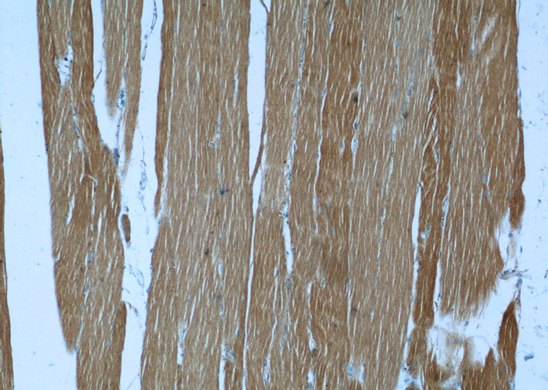 Immunohistochemistry of paraffin-embedded human skeletal muscle slide using Catalog No:114862(RTN2 Antibody) at dilution of 1:50