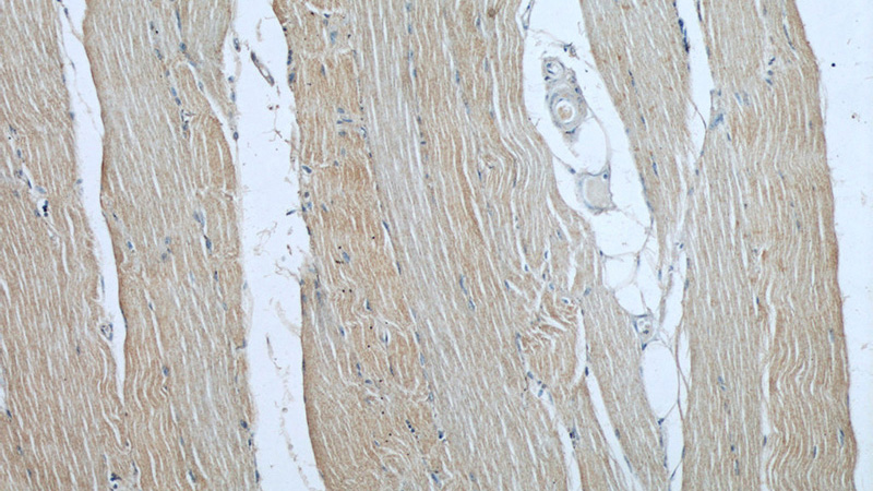 Immunohistochemical of paraffin-embedded human skeletal muscle using Catalog No:107492(RAB27A antibody) at dilution of 1:50 (under 10x lens)