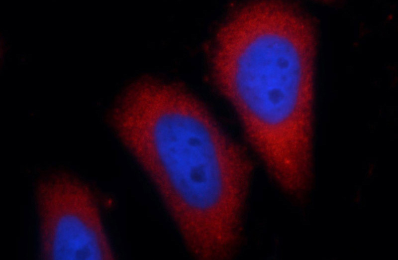 Immunofluorescent analysis of HeLa cells using Catalog No:113826(PHLPPL Antibody) at dilution of 1:25 and Rhodamine-Goat anti-Rabbit IgG