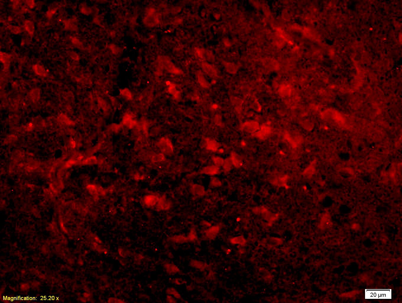 Fig3: Immunofluorescence.; Tissue/cell: human placenta tissue;4% Paraformaldehyde-fixed and paraffin-embedded;; Antigen retrieval: citrate buffer ( 0.01M, pH 6.0 ), Boiling bathing for 15min; Blocking buffer (normal goat serum,C-0005) at 37℃ for 20 min;; Incubation: Anti-Nociceptin receptor Polyclonal Antibody, Unconjugated 1:200, overnight at 4℃; The secondary antibody was Goat Anti-Rabbit IgG, Cy3conjugated (bs-0295G-Cy3)used at 1:200 dilution for 40 minutes at 37℃.
