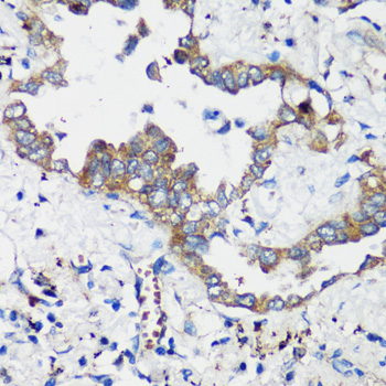 Immunohistochemistry - ELP3 Polyclonal Antibody 
