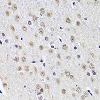 Immunohistochemistry - CCDC59 Polyclonal Antibody 