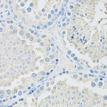 Immunohistochemistry - SLC2A9 Polyclonal Antibody 