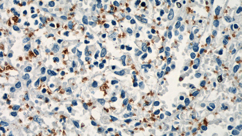Immunohistochemical of paraffin-embedded human spleen using Catalog No:109122(GP1BA antibody) at dilution of 1:50 (under 40x lens)