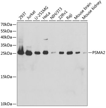 Western blot - PSMA2 Polyclonal Antibody 
