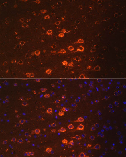Immunofluorescence - NEFM Polyclonal Antibody 