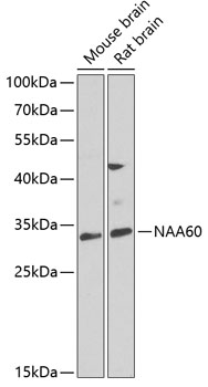 Western blot - NAA60 Polyclonal Antibody 