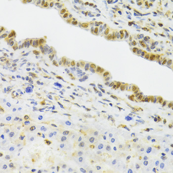 Immunohistochemistry - EFTUD2 Polyclonal Antibody 