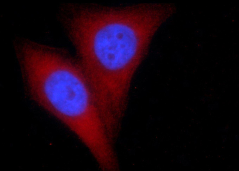 Immunofluorescent analysis of HepG2 cells using Catalog No:107467(PGM1 Antibody) at dilution of 1:50 and Rhodamine-Goat anti-Mouse IgG