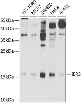 Western blot - IER3 Polyclonal Antibody 