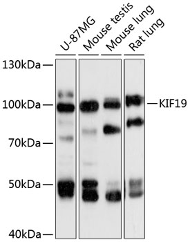 Western blot - KIF19 Polyclonal Antibody 