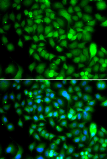 Immunofluorescence - CSRP2BP Polyclonal Antibody 