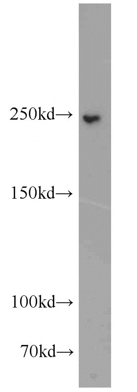 human placenta tissue were subjected to SDS PAGE followed by western blot with Catalog No:107929(AKAP11-Specific antibody) at dilution of 1:100