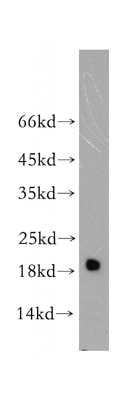 mouse heart tissue were subjected to SDS PAGE followed by western blot with Catalog No:112995(MYL2 antibody) at dilution of 1:1000