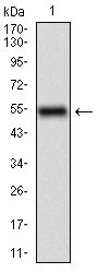 Fig1: Western blot analysis of CD68 on human CD68 recombinant protein using anti-CD68 antibody at 1/1,000 dilution.