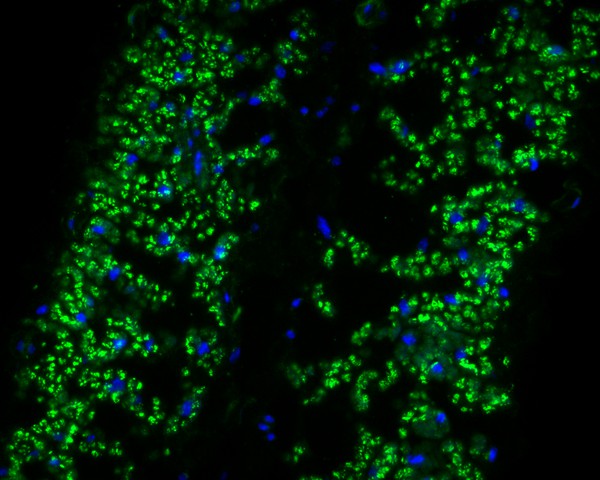 Fig1:; Immunohistochemical analysis of paraffin-embedded A. thaliana tissue using anti-Beta-adaptin-like protein A antibody. The section was pre-treated using heat mediated antigen retrieval with Tris-EDTA buffer (pH 8.0-8.4) for 20 minutes.The tissues were blocked in 5% BSA for 30 minutes at room temperature, washed with ddH; 2; O and PBS, and then probed with the primary antibody ( 1/50) for 30 minutes at room temperature. The detection was performed using an HRP conjugated compact polymer system. DAB was used as the chromogen. Tissues were counterstained with hematoxylin and mounted with DPX.