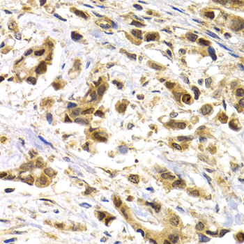 Immunohistochemistry - MAGEA1 Polyclonal Antibody 