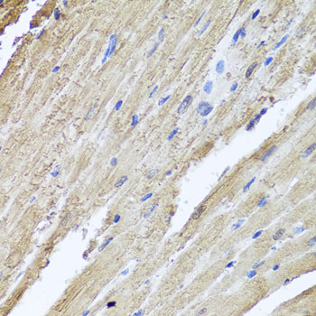 Immunohistochemistry - PIK3C2A Polyclonal Antibody 