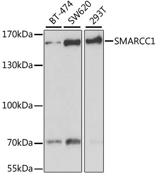 Western blot - SMARCC1 Polyclonal Antibody 