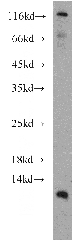 MCF7 cells were subjected to SDS PAGE followed by western blot with Catalog No:110007(DMRTC1B antibody) at dilution of 1:500