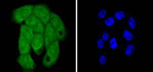 Fig2:; ICC staining of Histone H2B in A431 cells (green). Formalin fixed cells were permeabilized with 0.1% Triton X-100 in TBS for 10 minutes at room temperature and blocked with 1% Blocker BSA for 15 minutes at room temperature. Cells were probed with the primary antibody ( 1/50) for 1 hour at room temperature, washed with PBS. Alexa Fluor®488 Goat anti-Rabbit IgG was used as the secondary antibody at 1/1,000 dilution. The nuclear counter stain is DAPI (blue).
