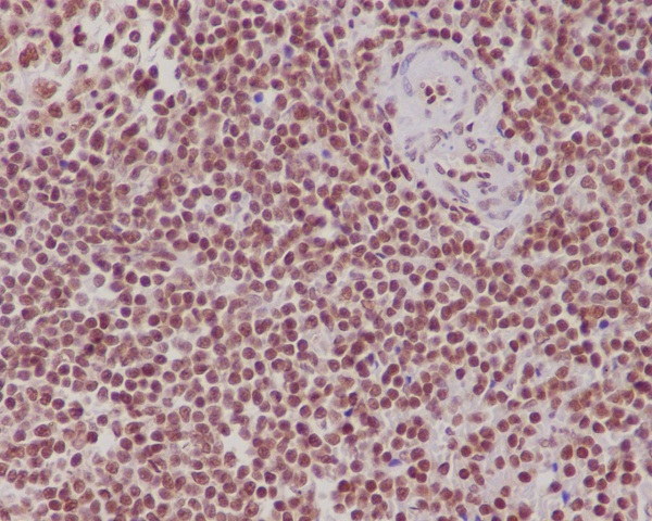 Immunohistochemical analysis of paraffin-embedded human spleen, using FUBP1 Antibody.