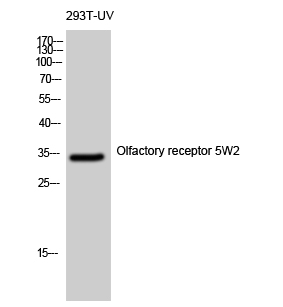 Fig1:; Western Blot analysis of 293T-UV cells using Olfactory receptor 5W2 Polyclonal Antibody diluted at 1: 500