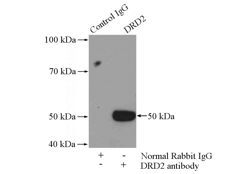 IP Result of anti-DRD2 (IP:Catalog No:110016, 4ug; Detection:Catalog No:110016 1:300) with SH-SY5Y cells lysate 3000ug.