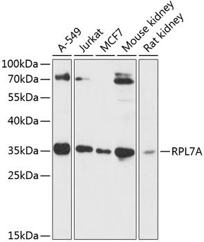 Western blot - RPL7A Polyclonal Antibody 