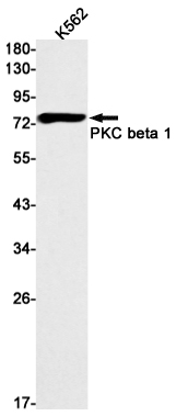 Western blot detection of PKC beta 1 in K562 cell lysates using PKC beta 1 Rabbit mAb(1:1000 diluted).Predicted band size:77kDa.Observed band size:77kDa.