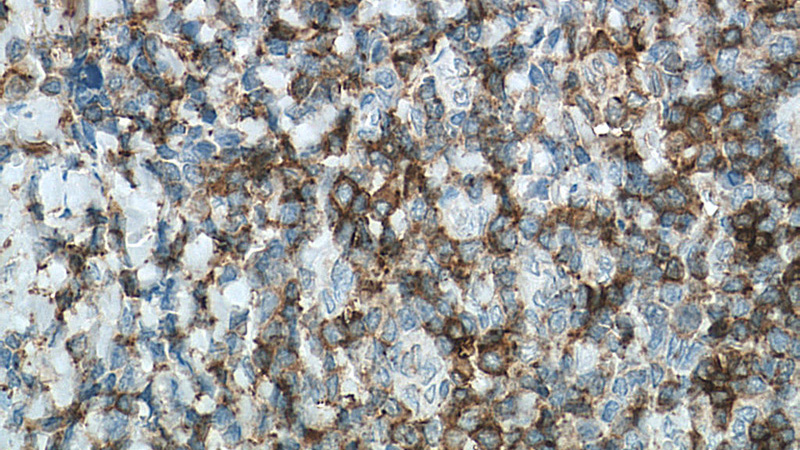 Immunohistochemistry of paraffin-embedded human tonsillitis tissue slide using Catalog No:107127(CD27 Antibody) at dilution of 1:200 (under 40x lens). heat mediated antigen retrieved with Tris-EDTA buffer(pH9).